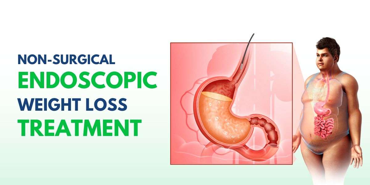 Endoscopic Weight Loss Treatment